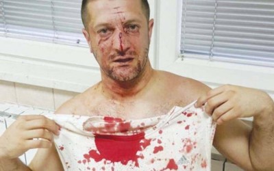 Direktor ŠG “Romanija” isječen na stadionu